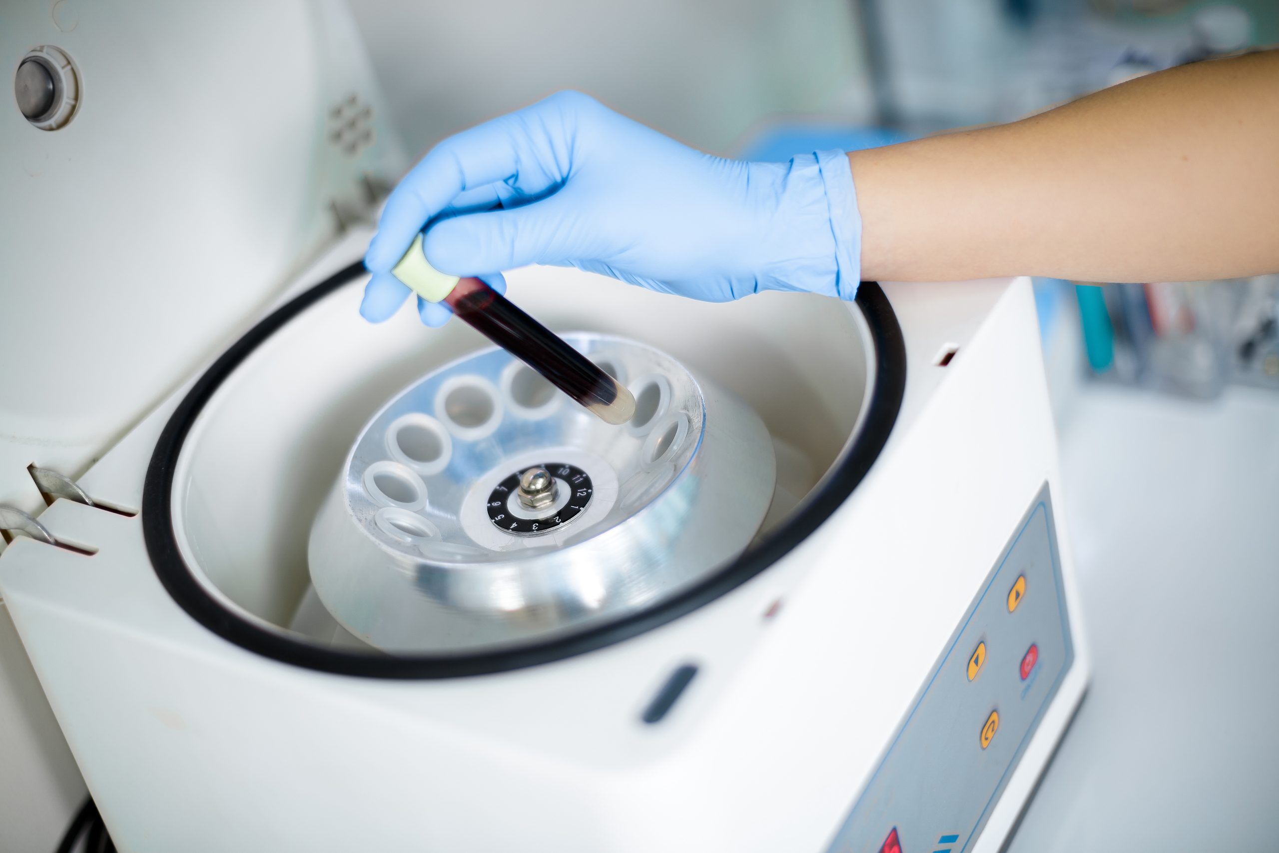 Zentrifuge in einem medizinischen Labor wird mit Blutampullen befüllt und benötigt Hochgeschwindigkeitsfette, um optimal zu funktioneren